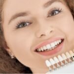 Porcelain dental veneers