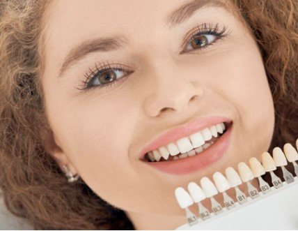 Porcelain dental veneers