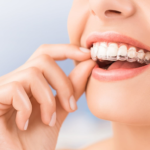 How to Find an Aligner Option That Fits Your Daily Routine